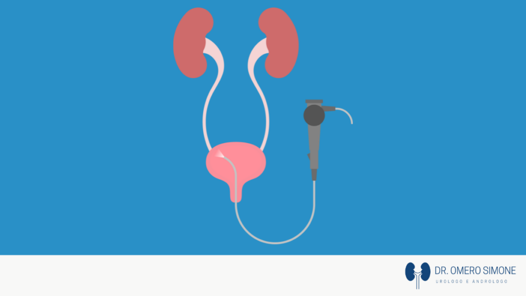 Cistoscopia flessibile – Ambu a scope: Cos’è e come si effettua?